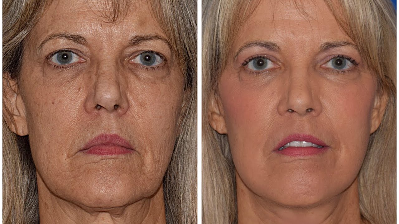 Robb Facial Plastic Surgery