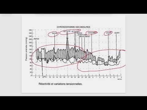 Extrait objectif 38 – Hypertension artérielle