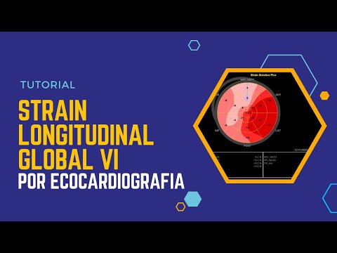 💹STRAIN LONGITUDINAL GLOBAL VI 🔊[Ecocardiografía]