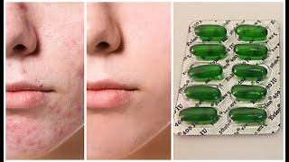 i Apply Vitamin E Oil On My Face & Look What Happened, Amazing Uses of Vitamin E Capsules