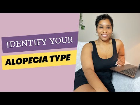 Understanding the Different Types of Alopecia