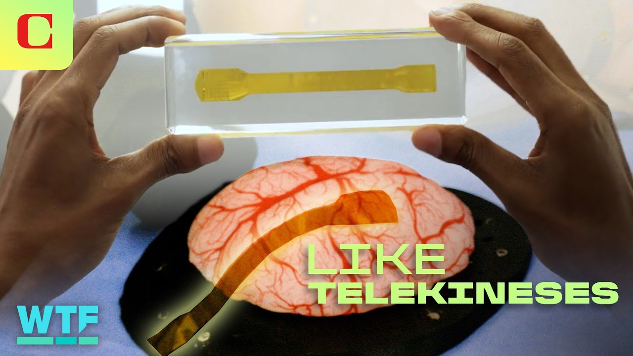 This Removable Brain-Computer Implant Feels 'Like Telekinesis'