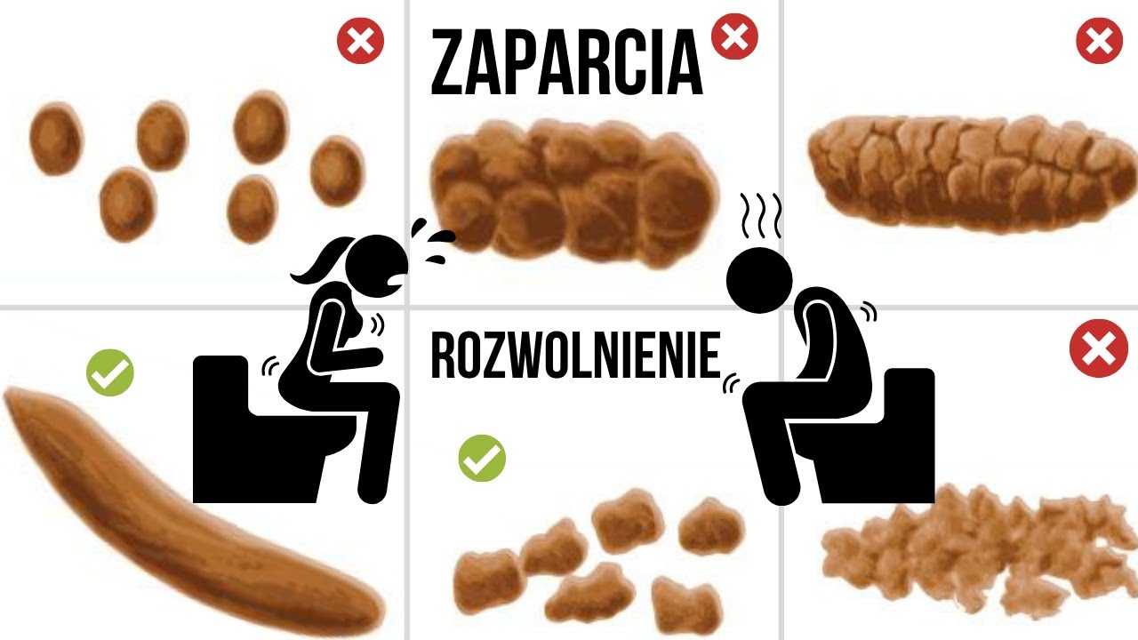 12 typów stolców: żółty, zielony, biały – co oznaczają?