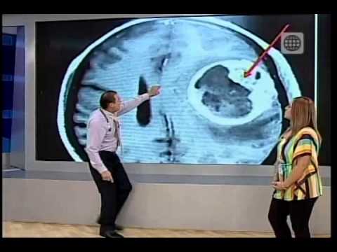 Dr. TV Perú (02-06-2014) - B1 - Tema del día: Síntomas Fatales