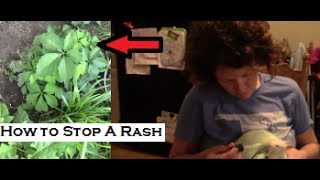 How to get rid of poison ivy rash FOREVER!!
