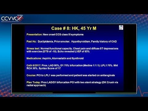 Prox LAD/D1 Bifurcation PCI with 2-Stent Strategy (DK Crush via Radial) - 2018 Live Case 8
