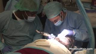 Modena FUE Hair Transplant Las Vegas & Orange County