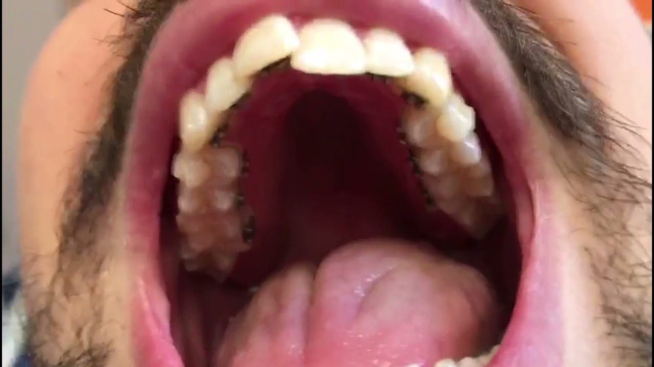 Pasquale Cozzolino-10