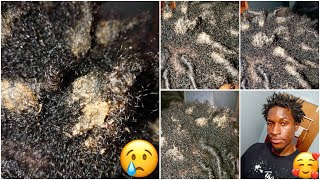 DON&#39;T Do This With Your Starter Locs!!! How I Had To Save My Starter Locs. (Comb Coil Twist)