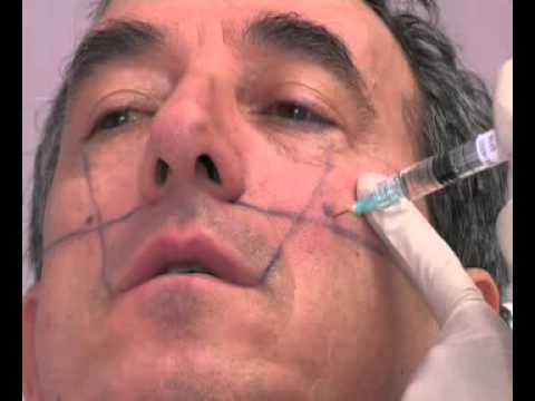 Maschera per occhi sulla base di vitamine E ed e Le maschere per togliere hypostases da una faccia
