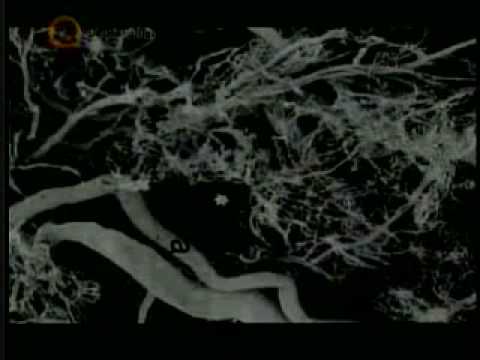 Maths of Fractal Geometry Pt 7/9