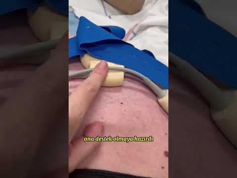 Üçüz Bebek Dünyaya Getiren Harika Anne 👶 👩