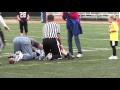 Youth Football Worst Injury Ever