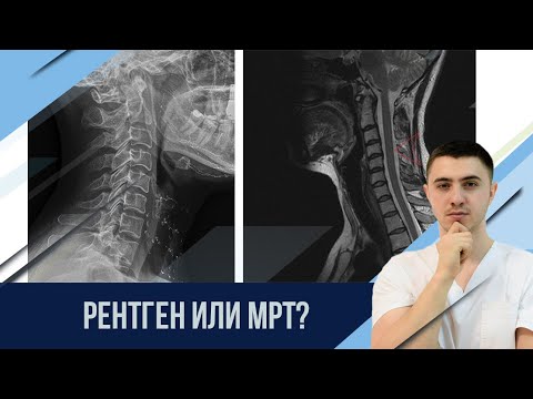 Рентген или МРТ позвоночника - что лучше?