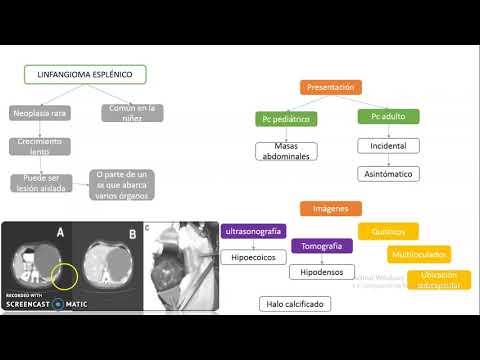 Neoplasias malignas y benignas del bazo