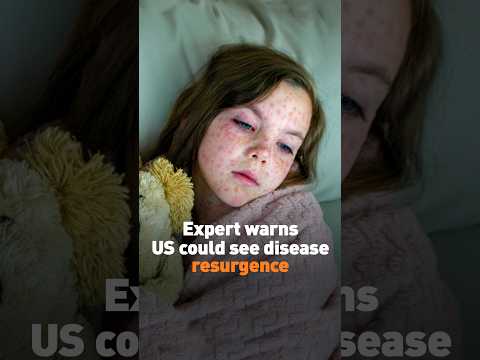Expert warns US could see resurgence of diseases