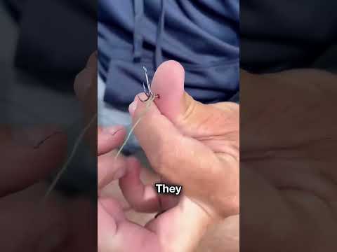 Fishing Hook Got Stuck😨