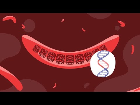 Gene Therapy and Sickle Cell Disease