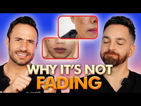 11 Dark Spot & Hyperpigmentation Mistakes Ruining Your Skin