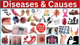 Discover the 100 Most Shocking Diseases and Their Surprising Origins