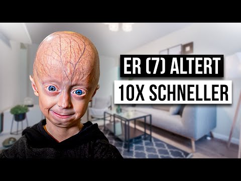 Wie ist das PROGERIE ZU HABEN?