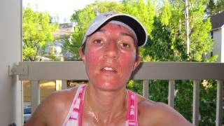DermTV - Why Exercise Makes Your Face Red [DermTV.com Epi #286]