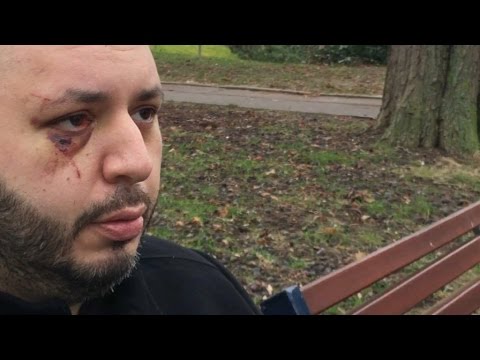 « Il ne faut plus se laisser faire », l’élu de Dammarie-les-Lys agressé par des jeunes se confie