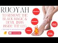 Ultimate Ruqyah To Remove Black Magic Devil Inside Legs Causing Movement Pain Numbness Burning Etc
