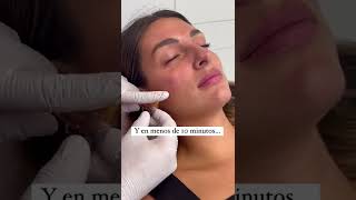 #SHORTS 🐼 ¡OJERAS! 🐼 Nuestro #TotalEyes se adapta a las necesidades de cada ojera.