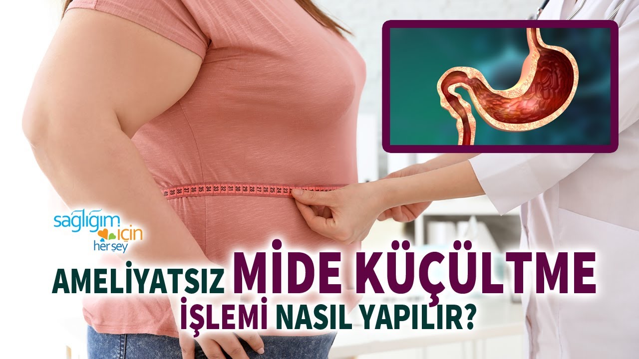 Endoskopik Mide Küçültme İşleminden Önce ve Sonra Dikkat Edilmesi Gerekenler