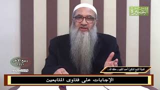 صورة ما حكم الوشم للرجال؟