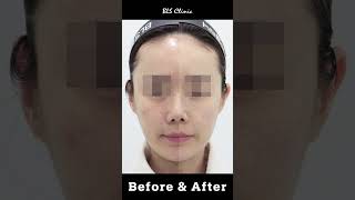BLS클리닉 압구정본원_이동진 대표원장님 인터뷰