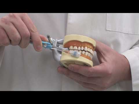 download lagu mp3 mp4 Is Baking Soda Abrasive To Teeth, download lagu Is Baking Soda Abrasive To Teeth gratis, unduh video klip Is Baking Soda Abrasive To Teeth