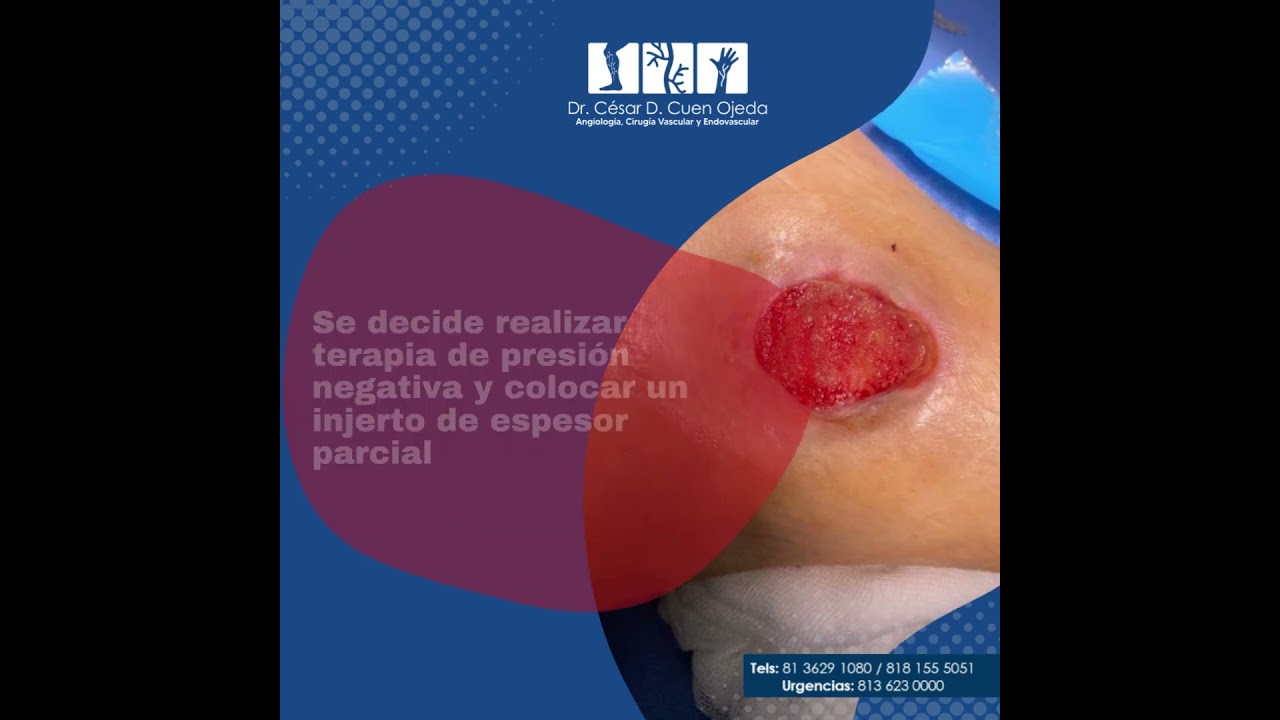 César Daniel Cuen Ojeda-24