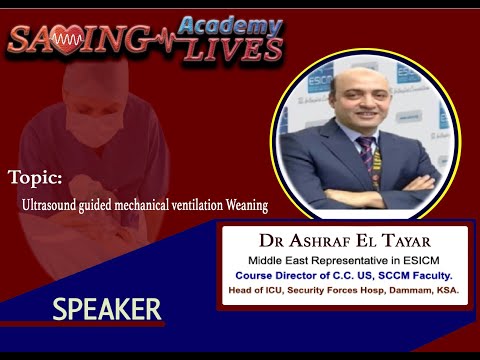 Ultrasound guided mechanical ventilation Weaning