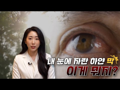 눈에 자란 하얀 막.. 시력까지 잃을 수 있어요