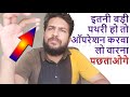 Pathri Ka Operation Kab Aur Kitni Badi Pathari Ho Tab Karna Chahiye