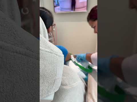 Ozone Therapy in Dubai, UAE by Maison Sante Clinic: A Patient's Wellness Journey