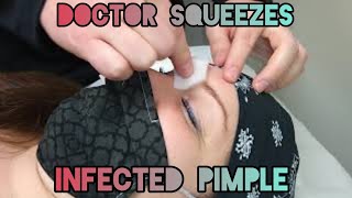 The Danger of Having Abscessed Pimple Between Eyebrows | Infected Follicle