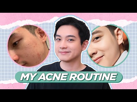 Everything I do for my ACNE, from MOST to LEAST important (Filipino) | Jan Angelo