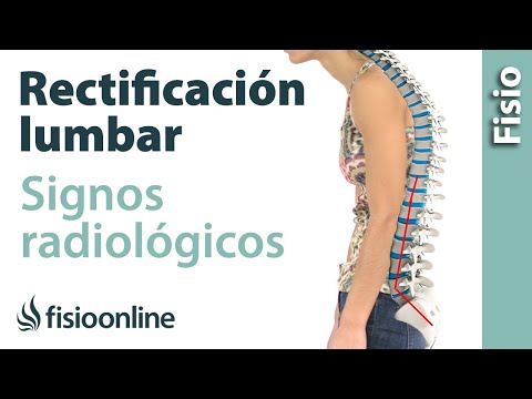 Dolore alla colonna cervicale dopo un infortunio Lombalgia e una sensazione di bruciore di piedi