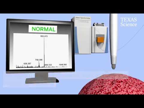 Caneta detectora de câncer entrará em nova fase de testes