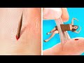 If a SPLINTER Was A PERSON!😼 LIFE-SAVING Hacks For Clumsy People