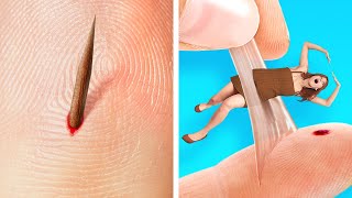 If a SPLINTER Was A PERSON!😼 LIFE-SAVING Hacks For Clumsy People