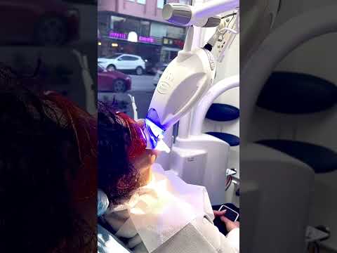 Bleaching (diş beyazlatma) nedir?