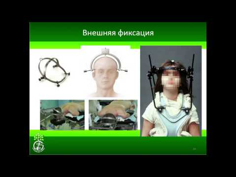 Упражнения для коленных суставов доктора евдокименко видео Йод действие на суставы