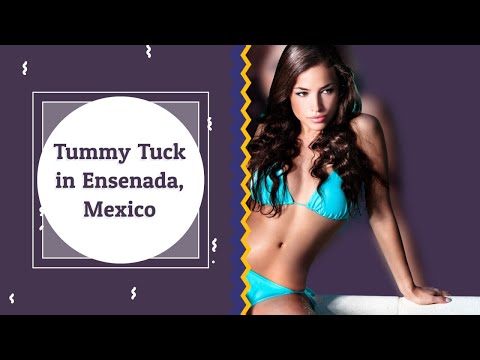 Learn Key Information About Tummy Tuck in Ensenada, Mexico
