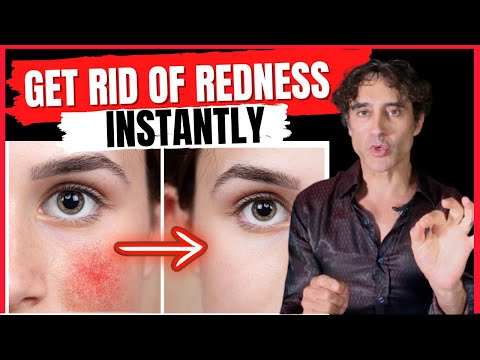 HOW TO GET RID OF REDNESS AND BLOOD VESSELS ON THE FACE