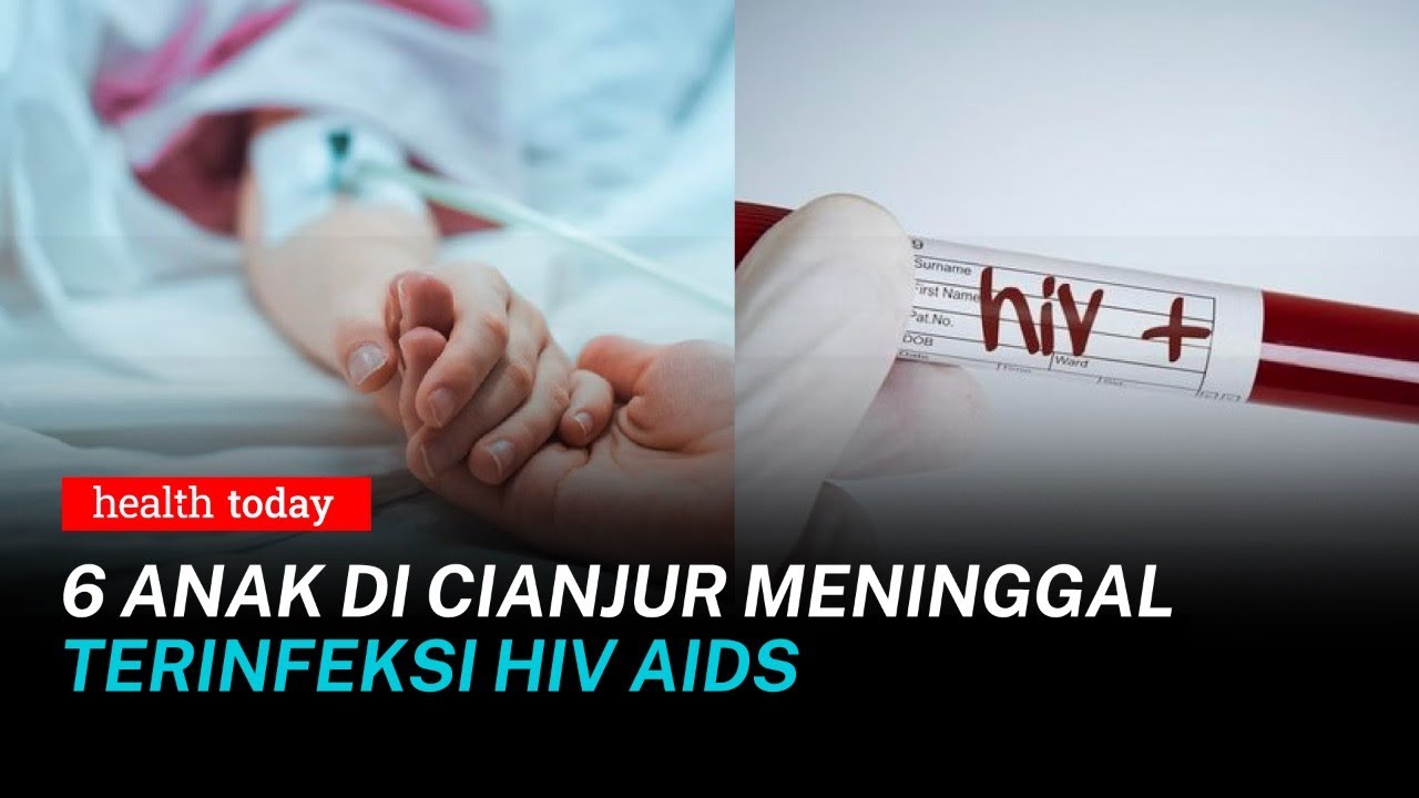 6 Anak di Cianjur Meninggal Terinfeksi HIV-AIDS, Kenali Penyebab Penularannya | Health Today #201