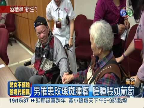 切除巨型"酒糟鼻" 男重獲新生!